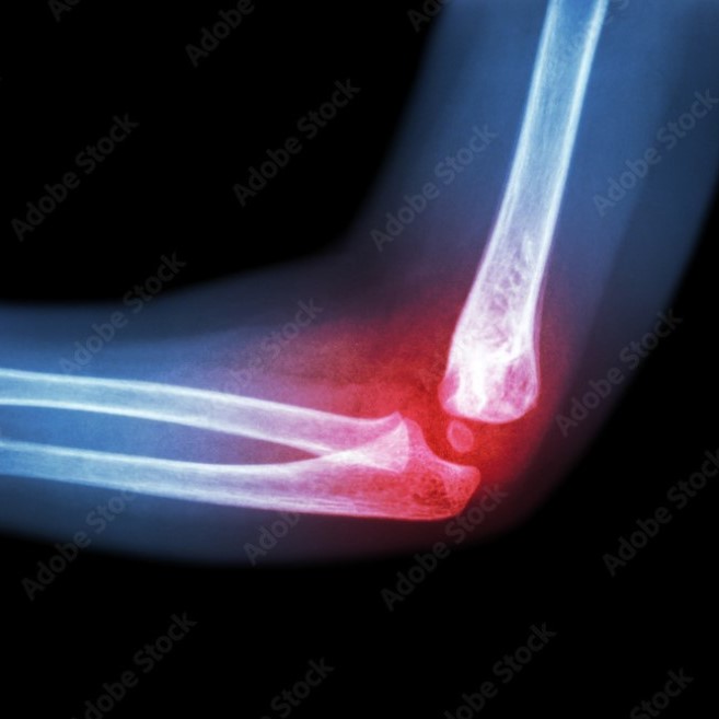 Reumatologia | Selene Centro Medico Bergamo